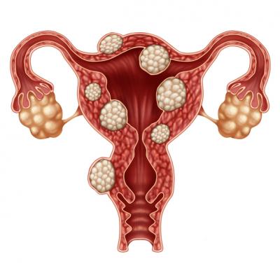 menopause fatigue