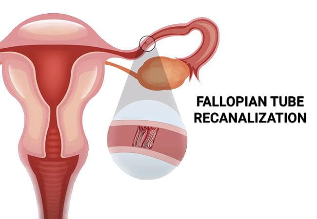 menopause fatigue